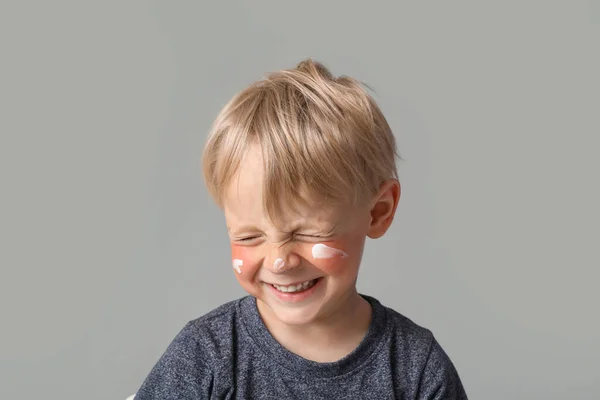 Niño Alérgico Con Cara Quemada Por Sol Crema Sobre Fondo —  Fotos de Stock