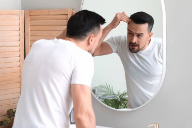 Evde aynaya bakarken saç dökülmesi sorunu olan endişeli genç bir adam.