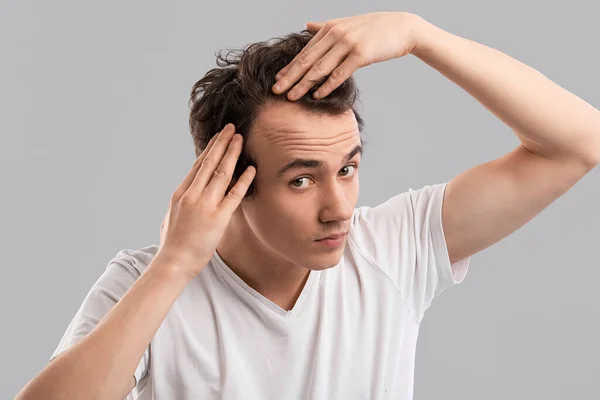 Young Man Hair Loss Problem Grey Background — Stock Photo, Image
