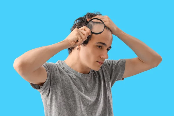 Young Man Hair Loss Problem Magnifier Blue Background — Stock Photo, Image