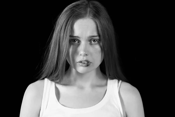 Ушибленная Молодая Женщина Темном Фоне Крупный План Концепция Домашнего Насилия — стоковое фото