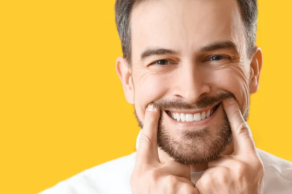 Усміхнений Молодий Чоловік Здоровими Зубами Жовтому Тлі Крупним Планом — стокове фото