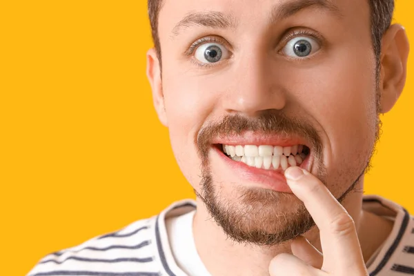 Молодий Бородатий Чоловік Показує Зуби Жовтому Тлі Крупним Планом — стокове фото