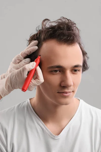 Doctor Marking Young Man Forehead Hair Loss Problem Grey Background — Stock Photo, Image