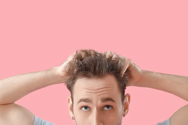 Young Man Hair Loss Problem Pink Background Closeup — Stock Photo, Image