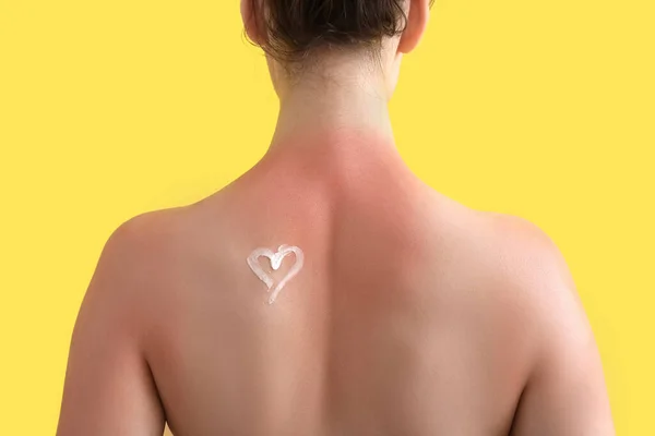 Αλλεργική Νεαρή Γυναίκα Ηλιοκαμένο Δέρμα Και Καρδιά Από Κρέμα Κίτρινο — Φωτογραφία Αρχείου