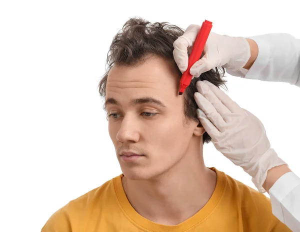 Doktor Genç Adamın Alnını Beyaz Arka Planda Saç Dökülme Problemiyle — Stok fotoğraf