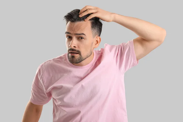 Worried Young Man Hair Loss Problem Grey Background — Stock Photo, Image