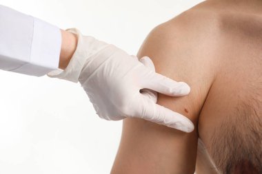 Dermatolog beyaz arka planda genç bir adamın benini inceliyor, yakın plan.