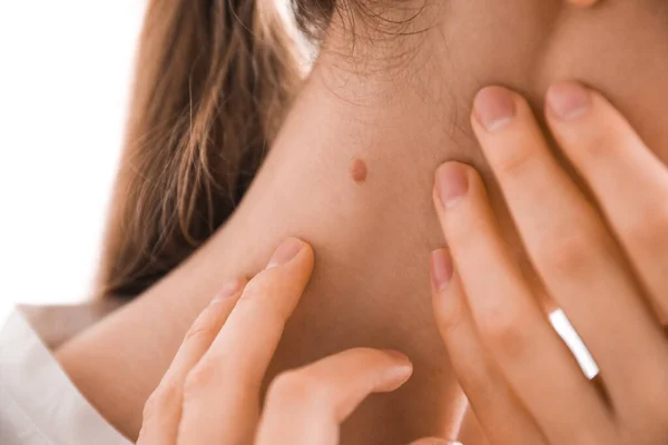 Wanita Muda Dengan Tahi Lalat Lehernya Klinik Closeup — Stok Foto