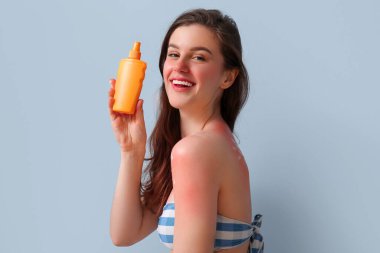 Alerjisi olan genç bir kadın. Mavi arka planda güneş yanığı ve kremi var.