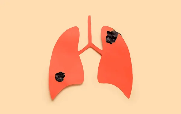 Papierowe Płuca Guzami Beżowym Tle Koncepcja Raka Płuc — Zdjęcie stockowe