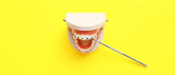 黄色の背景に歯ブラシと歯科医のツールを備えた顎のモデル — ストック写真