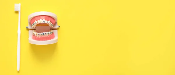 Mandíbulas Plástico Com Aparelho Dentário Escova Dentes Fundo Amarelo Com — Fotografia de Stock
