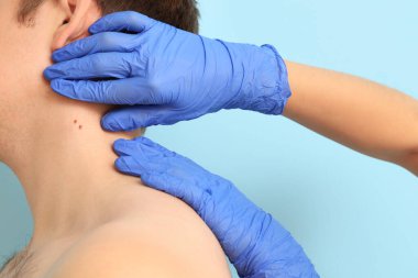 Dermatolog, genç adamın boynundaki benleri mavi arka planla karşılaştırıyor.