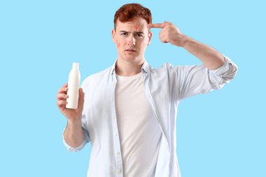 Mavi arka planda sivilce ilacı olan genç bir çocuk.