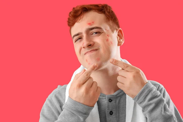 Teenager Junge Mit Akne Quetschenden Pickeln Auf Rotem Hintergrund — Stockfoto