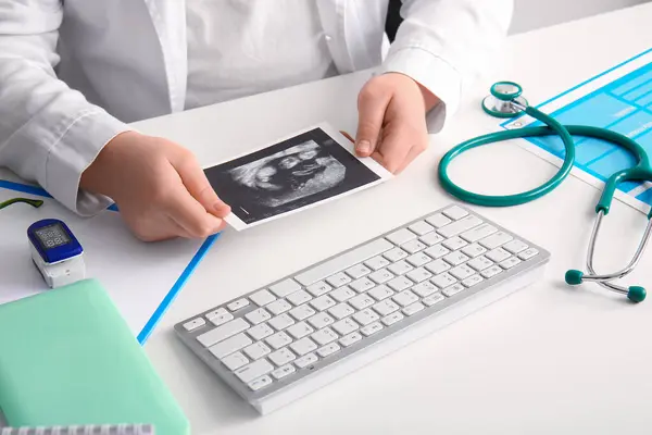 Female doctor with sonogram image at white medical desk, closeup
