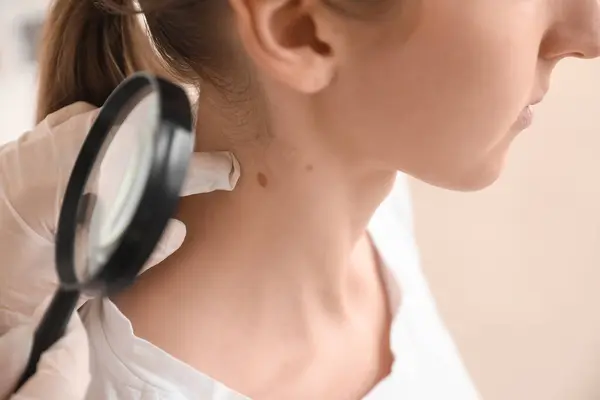 Dermatologist examining mole on young woman\'s neck with magnifier in clinic, closeup