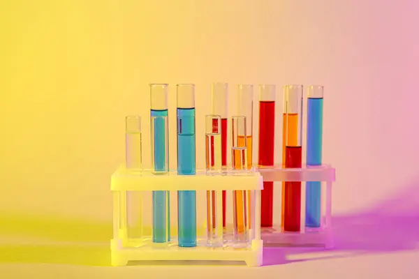 Test tubes with different samples in stands on colorful background