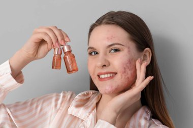 Sivilceli genç bir kadın ve arka planda bir şişe serum, yakın plan.