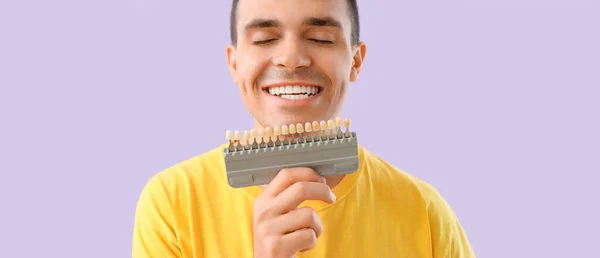 ライラックの背景に歯の色のサンプルを持つ幸せな若者 — ストック写真