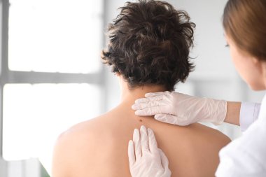 Dermatolog klinikte genç adamın sırtındaki beni inceliyor.