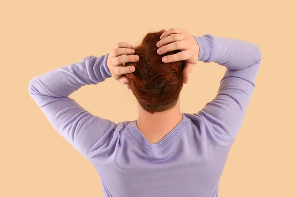 Young redhead man with problem of dandruff on beige background, back view