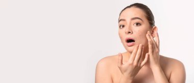 Açık arkaplanda akne sorunu olan genç bir kadın şok oldu.