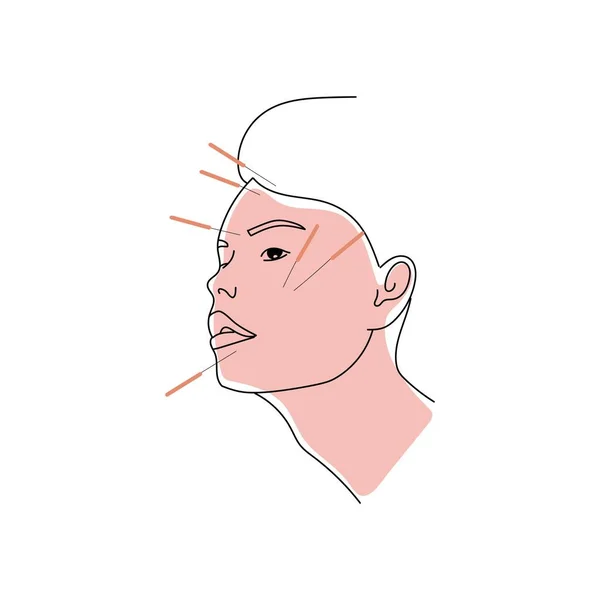 Face of person undergoing acupuncture on white background