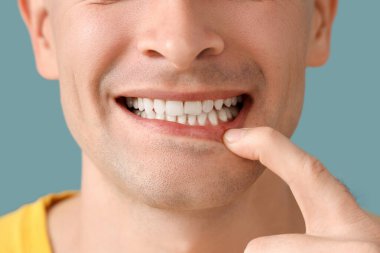 Mavi arka planda sağlıklı dişleri olan yakışıklı bir adam, yakın plan.