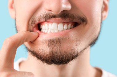 Mavi arka planda sağlıklı dişleri olan yakışıklı genç adam, yakın plan. Diş sağlığı konsepti