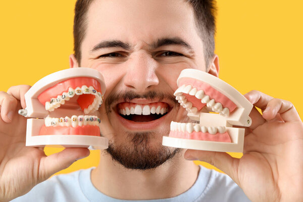 Handsome young man with models of jaw on yellow background. Dental care concept