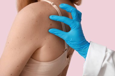 Dermatolog pembe arka planda benleri olan genç bir kadını muayene ediyor.