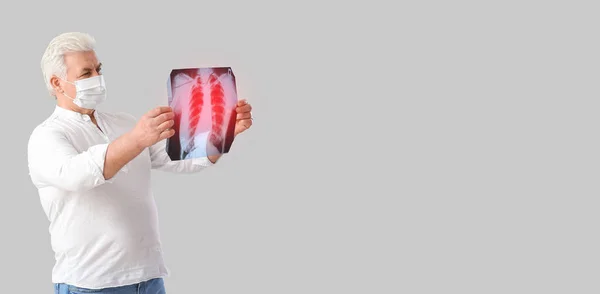 Senior Man Holding Ray Image Lungs Light Background Space Text — Stock Photo, Image