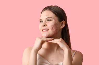 Pembe arka planda sivilce tedavisinden önce ve sonra genç bir kadının portresi 