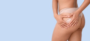 Vücudunda esneme izleri olan genç bir kadın cildine krem sürüyor açık mavi arkaplan ve yazı için yer var, yakın plan.