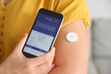 Glikoz sensörü olan şeker hastası bir kadın evdeki kan şekerini ölçmek için cep telefonu kullanıyor.