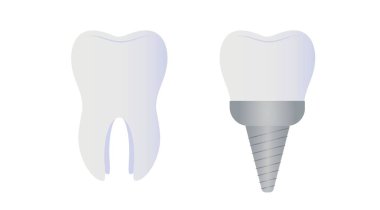 Beyaz arka planda doğal ve yerleştirilmiş dişler.