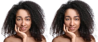 Beyaz arka planda burun ameliyatı öncesi ve sonrası genç Afro-Amerikalı kadın.