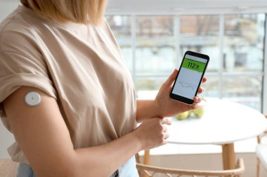 Glikoz sensörü olan şeker hastası bir kadın mutfaktaki kan şekerini ölçmek için cep telefonu kullanıyor.