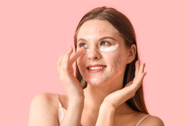 Sivilceli genç bir kadın ve pembe arka planda göz altı kremi, yakın plan.