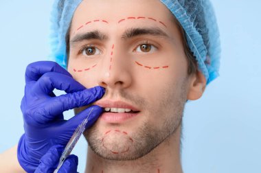 Yüzü işaretli genç adam mavi arka planda dudak enjeksiyonu alıyor, yakın plan. Estetik ameliyat konsepti