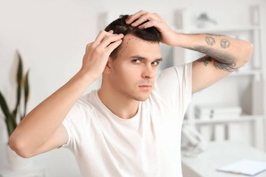Saç dökülmesi sorunu olan genç bir adam klinikte alnını işaretlemiş, yakın plan.