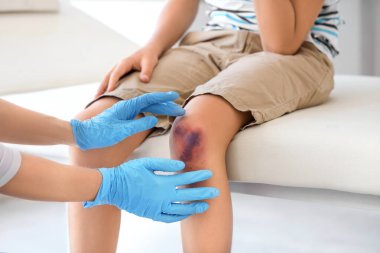 Little boy with bruised knee visiting doctor in clinic, closeup