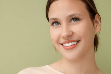 Yeşil arka planda sivilce sorunu olan güzel, genç bir kadın.