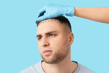 Doktor ve işaretli adamın alnında mavi arka planda saç kaybı sorunu var. Yakın plan.