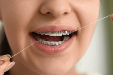 Diş teli kullanan genç bir kadın, yakın plan.