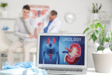 Ürolojistin ofisinde bilgisayarı aç, yakın plan.
