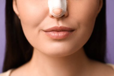 Leylak arka planında sargılı burunlu genç bayan, yakın plan. Estetik ameliyat konsepti